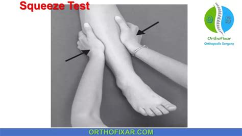 test for interosse membrane tear|The Syndesmosis Squeeze Test .